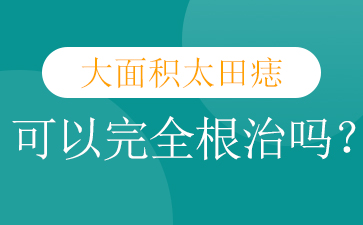 广州哪个医院去胎记好-太田痣的最佳治疗时间是什么时候?