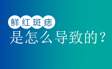 广东哪家医院治疗胎记-鲜红斑痣的危害有哪些